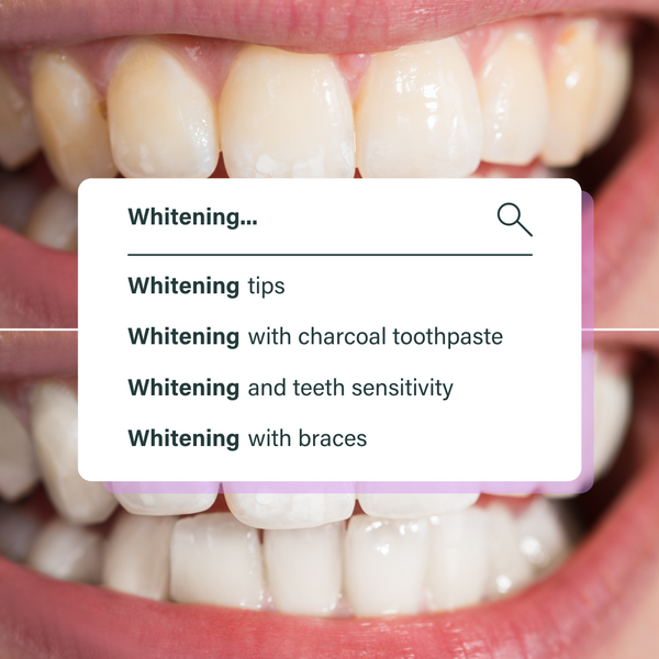 Frequently asked questions on teeth whitening (whitening FAQs) and teeth whitening tips by a cosmetic dental professional. Talks about charcoal toothpaste, whitening side effects and whitening with braces. 